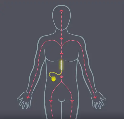 Image du système ARC